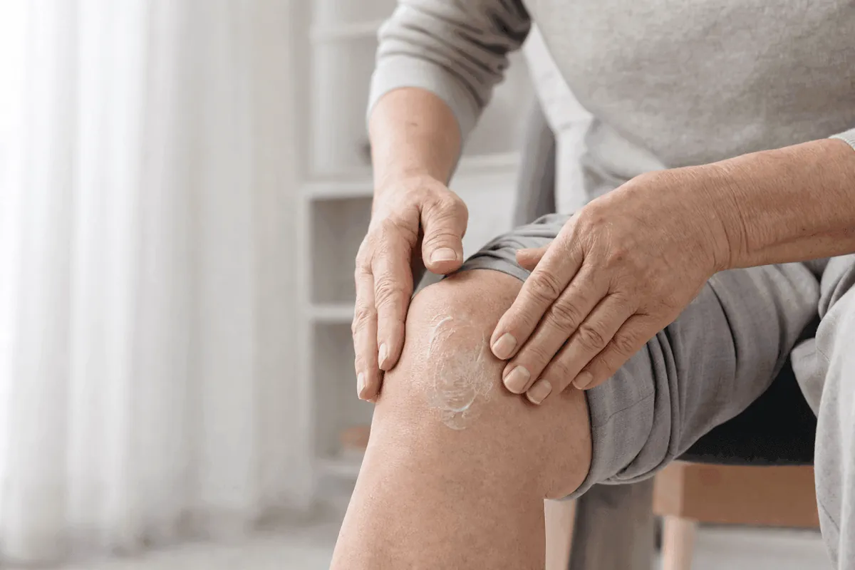 Tube d'Arthrovia posé à côté d'une noisette de crème étalée sur un genou